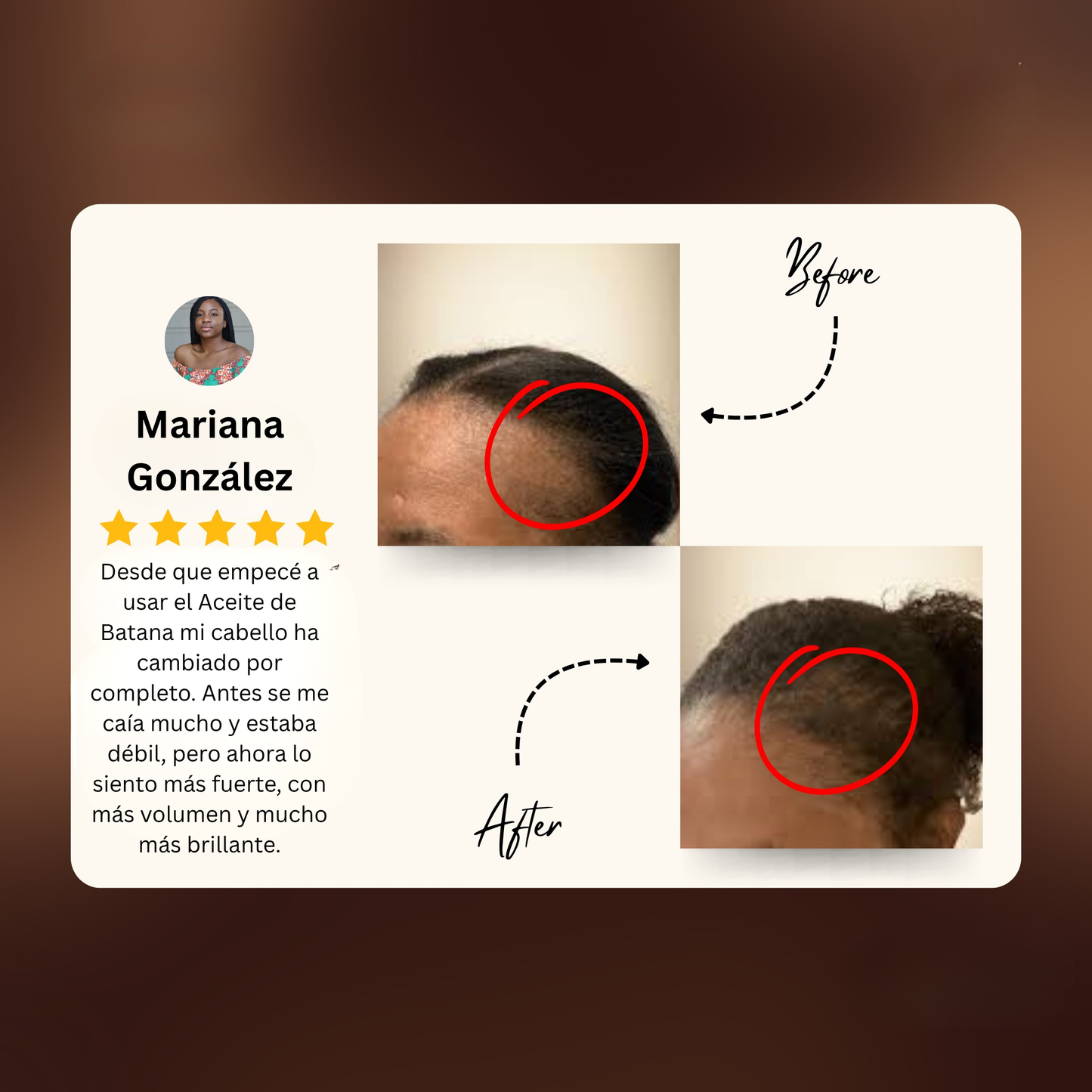 Aceite de Batana 100% Natural | Fortalece y Estimula el Crecimiento del Cabello