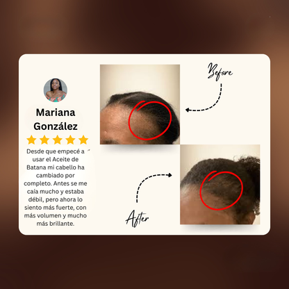 Aceite de Batana 100% Natural | Fortalece y Estimula el Crecimiento del Cabello